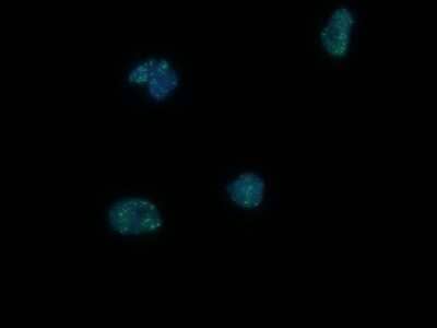 Immunocytochemistry/ Immunofluorescence: 53BP1 Antibody - BSA Free [NB100-904]