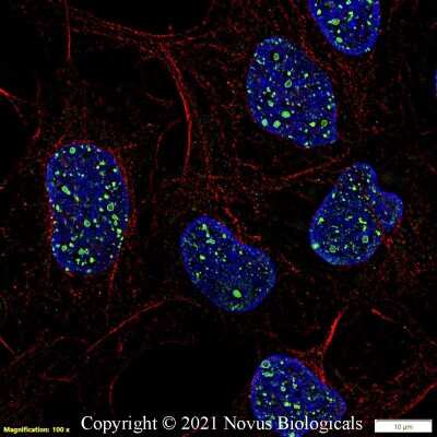 Immunocytochemistry/ Immunofluorescence: 53BP1 Antibody - BSA Free [NB100-904]