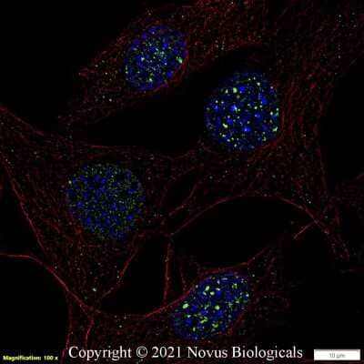 Immunocytochemistry/ Immunofluorescence: 53BP1 Antibody - BSA Free [NB100-904]