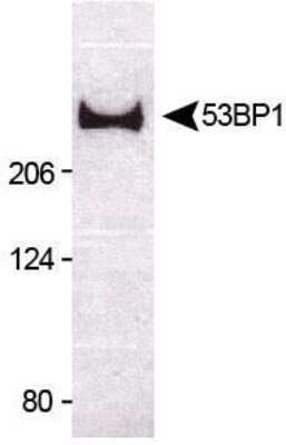 Western Blot: 53BP1 AntibodyBSA Free [NB100-904]