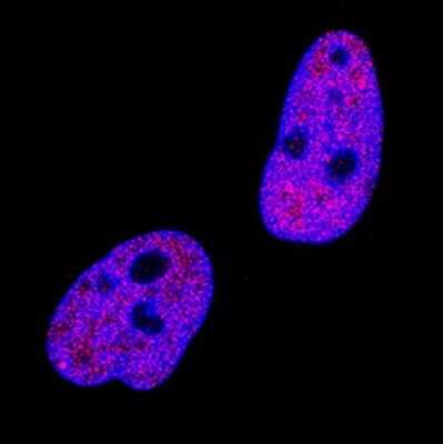 Immunocytochemistry: 53BP1 Antibody (1285A) - Azide and BSA Free [MAB18771]