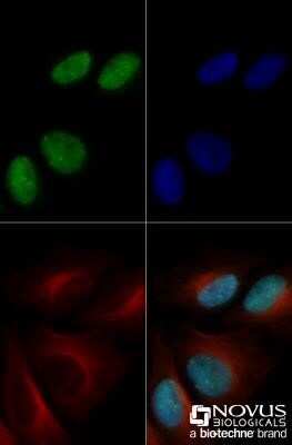 Immunocytochemistry/ Immunofluorescence: 53BP1 Antibody (1285C) - Azide and BSA Free [NBP2-80550]