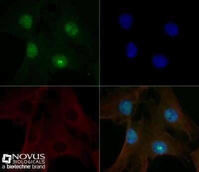 Immunocytochemistry/ Immunofluorescence: 53BP1 Antibody (1285C) - Azide and BSA Free [NBP2-80550]