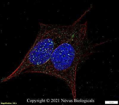 Immunocytochemistry/ Immunofluorescence: 53BP1 Antibody (1285C) - Azide and BSA Free [NBP2-80550]
