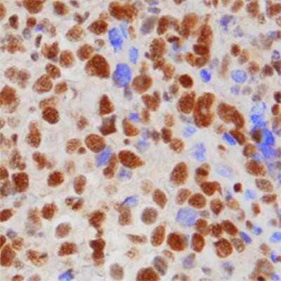 Immunohistochemistry-Paraffin: 53BP1 Antibody (1285C) - Azide and BSA Free [NBP2-80550]