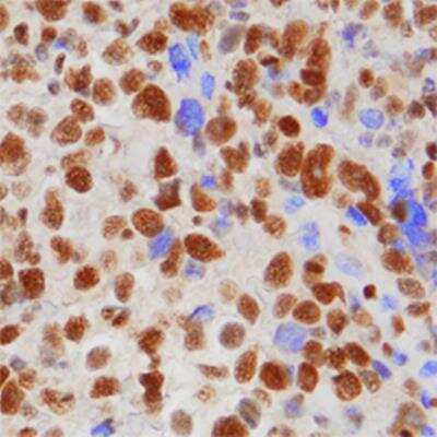 Immunohistochemistry-Paraffin: 53BP1 Antibody (1285C) - BSA Free [NBP2-54753]