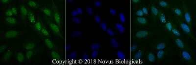 Immunocytochemistry/Immunofluorescence in HeLa Cells Using Conjugated 53BP1 Antibody