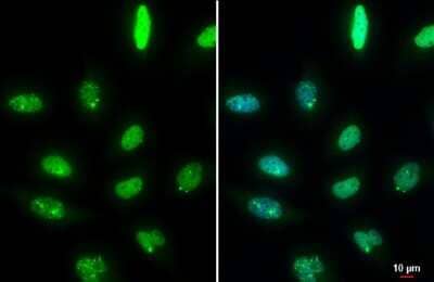 Immunocytochemistry/ Immunofluorescence: 53BP1 Antibody (HL275) [NBP3-13664]