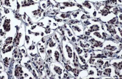 Immunohistochemistry-Paraffin: 53BP1 Antibody (HL275) [NBP3-13664]