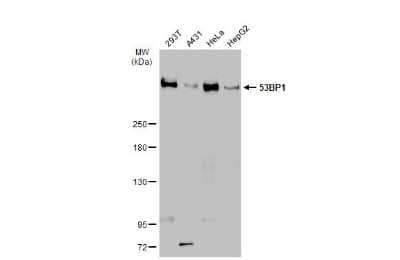 Western Blot: 53BP1 Antibody (HL275) [NBP3-13664]