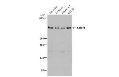 Western Blot: 53BP1 Antibody (HL275) [NBP3-13664]
