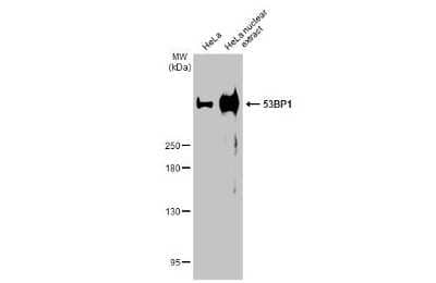 Western Blot: 53BP1 Antibody (HL275) [NBP3-13664]