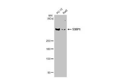 Western Blot: 53BP1 Antibody (HL275) [NBP3-13664]