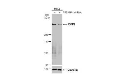 Western Blot: 53BP1 Antibody (HL275) [NBP3-13664]