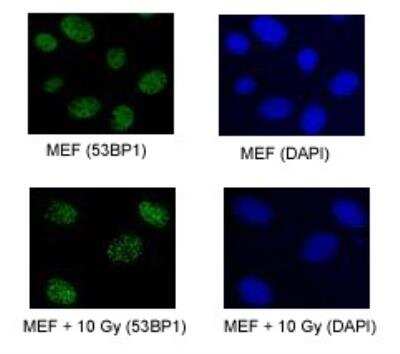 Immunocytochemistry/Immunofluorescence of Irradiated and Non-Irradiated MEFs