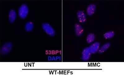 Immunocytochemistry/Immunofluorescence Staining of 53BP1 in Embryonic Fibroblast Cells