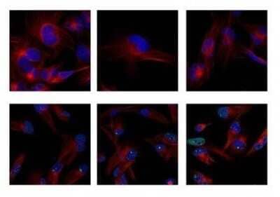 Probing of 53BP1 in Untreated and Irradiated Cells