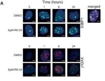 Fluorescent Detection of 53BP1 in Irradiated A549 Cells