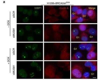 Immunocytochemistry/Immunofluorescence Staining of 53BP1 in Transfected H1299 Cells