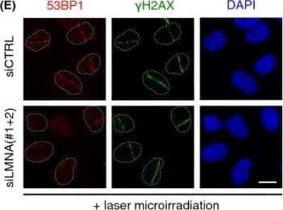 Immunofluorescence of 53BP1 in Transfected U2OS Cells