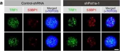 Immunocytochemistry/Immunofluorescence of 53BP1 in Control and shPot1a-1 Transduced LSK Cells