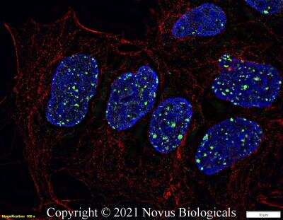 Immunofluorescent Staining of 53BP1 in Ntera2 Cells
