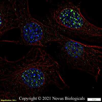 Immunofluorescent Staining of 53BP1 in NIH3T3 Cells
