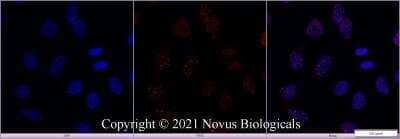 Immunocytochemistry/Immunofluorescence in HeLa Cells Using Conjugated 53BP1 Antibody