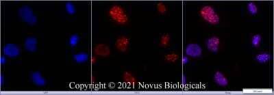 Immunocytochemistry/Immunofluorescence Staining of 53BP1 in HeLa Cells