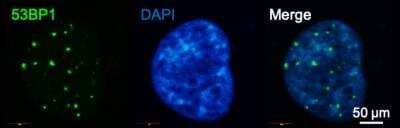 Immunocytochemistry/ Immunofluorescence: 53BP1 Antibody - BSA Free [NB100-305]