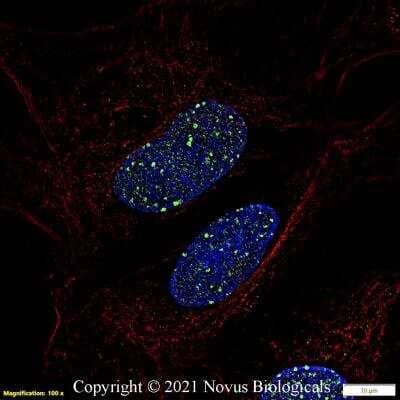 Immunocytochemistry/ Immunofluorescence: 53BP1 Antibody - BSA Free [NB100-305]