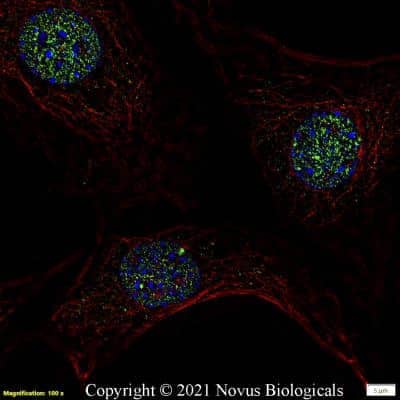 Immunocytochemistry/ Immunofluorescence: 53BP1 Antibody - BSA Free [NB100-305]