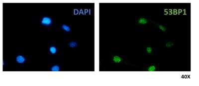 Immunocytochemistry/ Immunofluorescence: 53BP1 Antibody - BSA Free [NB100-305]