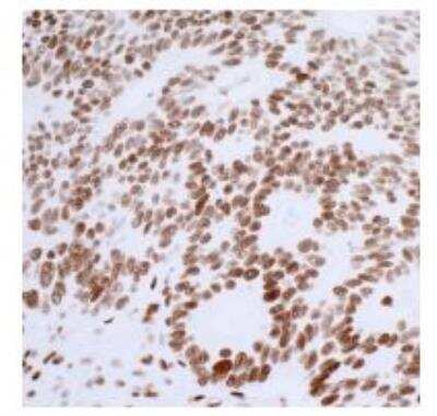 Immunohistochemistry: 53BP1 Antibody (BL-250-1H11) [NBP3-14667]