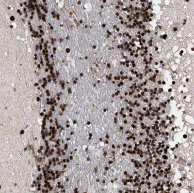 Immunohistochemistry-Paraffin: 53BP1 Antibody [NBP2-54677]