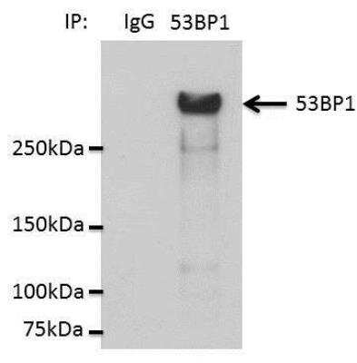 Detection of 53BP1 in Immunoprecipitated HCC44 Cell Lysate