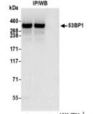 Immunoprecipitation: 53BP1 Antibody (BL-250-1H11) [NBP3-14667]