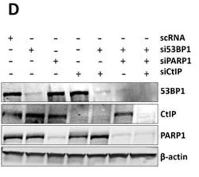 Knockdown Validated: 53BP1 Antibody - BSA Free [NB100-305]