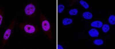 Knockout Validation of 53BP1 Antibody in HeLa and 53BP1 Knockout HeLa Cells in Immunocytochemistry/Immunofluorescence