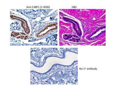 Immunohistochemistry: 53BP1 Antibody Pack [NB100-926]