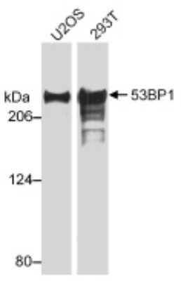 Western Blot: 53BP1 Antibody Pack [NB100-926]