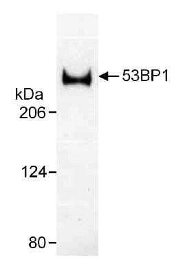 Western Blot: 53BP1 Antibody Pack [NB100-926]