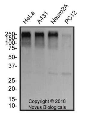 Western Blotting of 53BP1 in Multiple Cell Lines