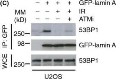 Western Blot of 53BP1 in U2OS Cells Exposed to Ionizing Radiation