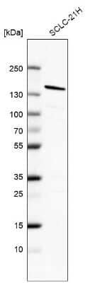 Western Blot: 53BP1 Antibody [NBP2-54659]