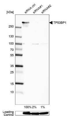 Western Blot: 53BP1 Antibody [NBP2-54677]