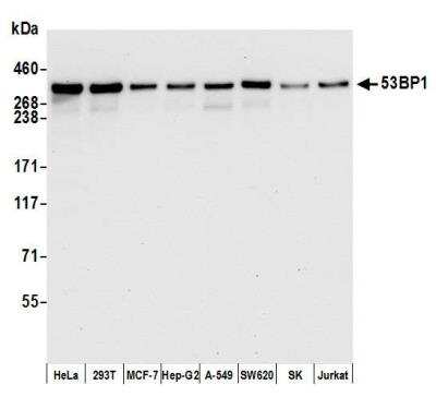 Western Blot: 53BP1 Antibody (BL-250-1H11) [NBP3-14667]