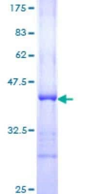 SDS-PAGE: Recombinant Human 53BP1 GST (N-Term) Protein [H00007158-Q01]