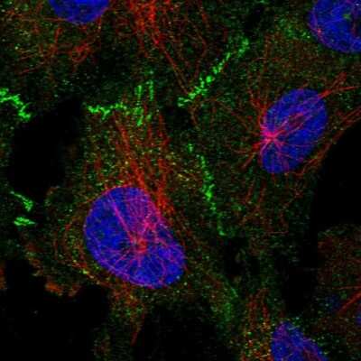 Immunocytochemistry/ Immunofluorescence: 53BP2 Antibody [NBP2-58677]