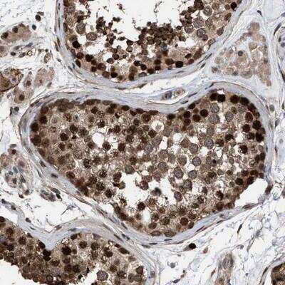 Immunohistochemistry: 53BP2 Antibody [NBP1-90324]